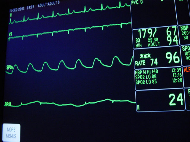 Know the warning signs that trigger alarms among lenders. (Photo by brykmantra; CC BY-SA 2.0)
