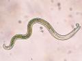 Some microscopic juvenile soybean cyst nematodes now have the ability to invade the roots of SCN-resistant varieties with PI 88788, a resistant source used in a majority of the SCN-resistant varieties, Image by Beck’s