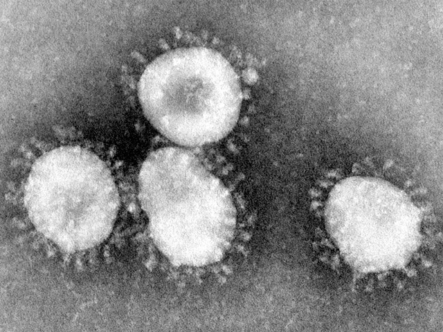 With the scare of the coronavirus growing, have you stopped to wonder what the facts are and what emotions are overdone? (Photo by CDC/Dr. Fred Murphy)